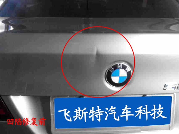凹陷修复修复前